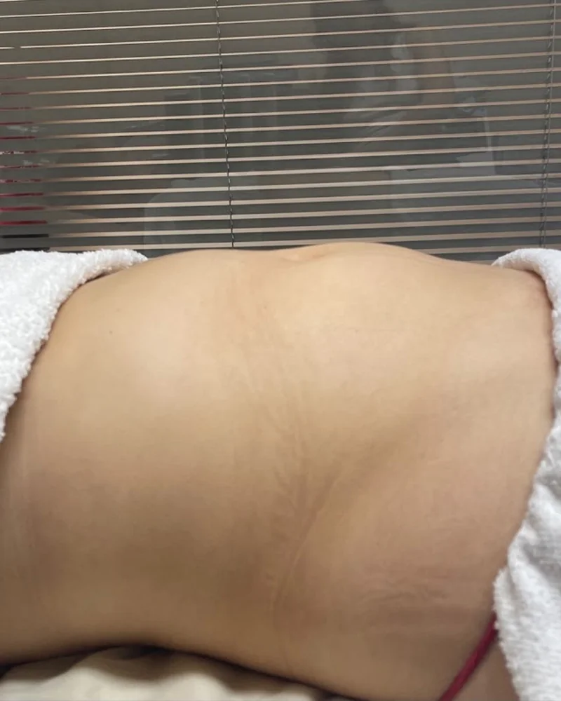 Tratamento corporal, resultado 5 (antes)