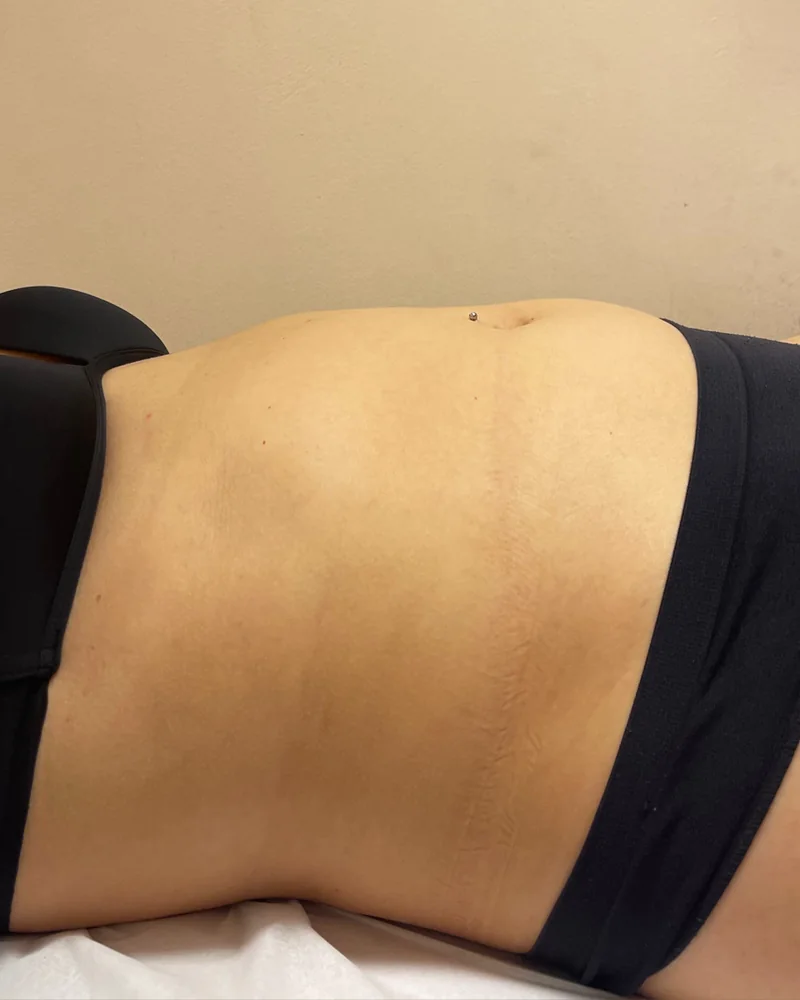 Tratamento corporal, resultado 6 (antes)