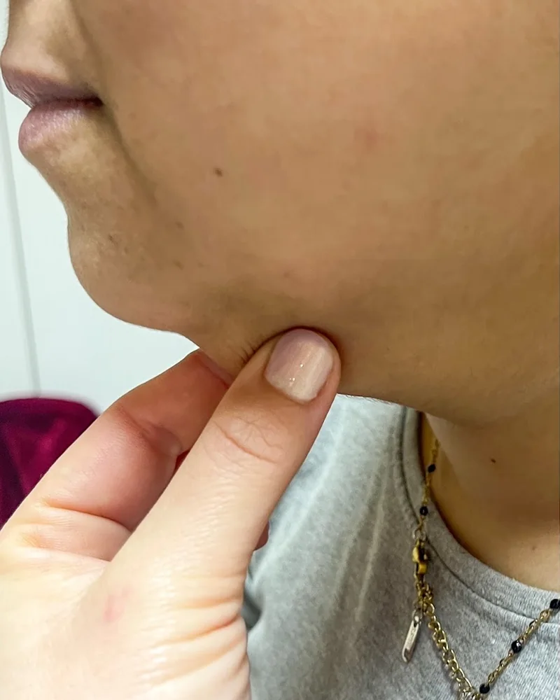 Tratamento facial: pele mais uniforme e luminosa (antes)